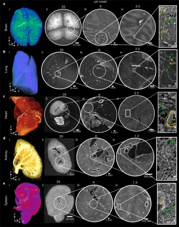 High-resolution 3D organ imaging showing detailed vascular structures